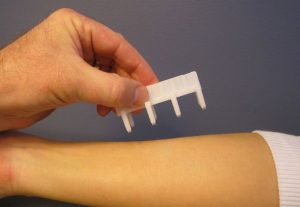 Pruebas cutáneas de alergia